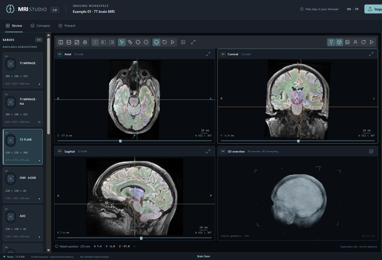 MRI Studio reviewing linked T2 FLAIR images and a 3D overview