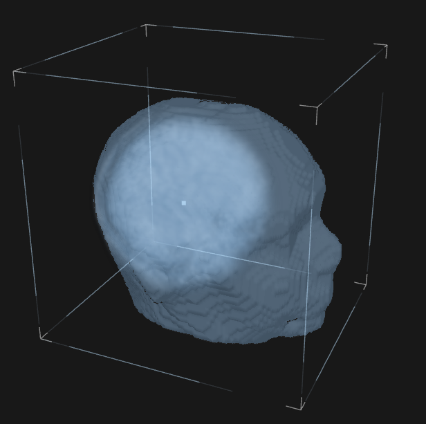 3D head-volume reconstruction in a spatial reference frame