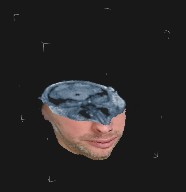 Experimental 3D view of a sliced MRI volume